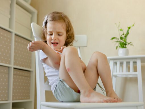 Child sitting on a white chair scratching their arm with visible red insect bites on their arms and legs in a bright indoor setting